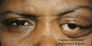 Mamalis Orbit 35 labeled
