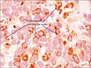 Mamalis Orbit 65 labeled