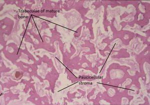 Mamalis Orbit 73 labeled