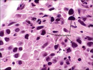 Mamalis Orbit 77 labeled
