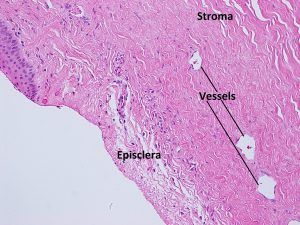 Mamalis Sclera 02 labeled