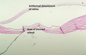 Mamalis Sclera 08 labeled