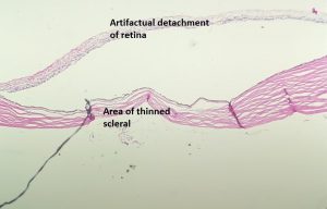 Mamalis Sclera 08 labeled