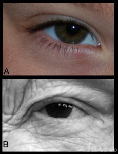 Fig_12_Aging_of_lashes
