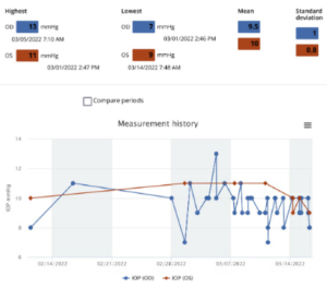 Figure 4: Summary of the results of iCare HOME measurements taken nine months after the glaucoma stent procedure OD. All the measurements were “excellent” in quality. Average IOP and variability of IOP in the right eye were now both lower compared to the iCare HOME measurements from one year prior.