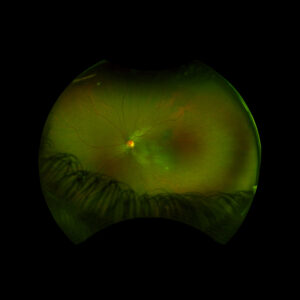 Johnson, Figure 1, Optos