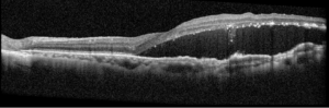 Shulz, Figure 2