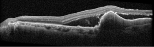 Shulz, Figure 3