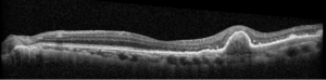 Shulz, Figure 7
